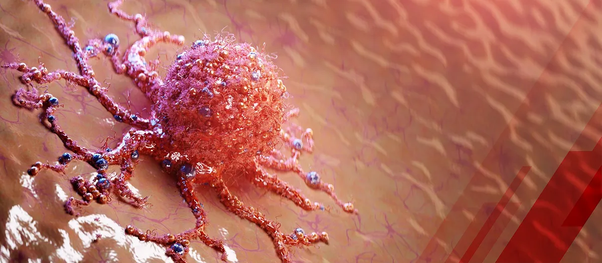 Top 10 Brachytherapy Companies Improving Cancer Treatment in 2024